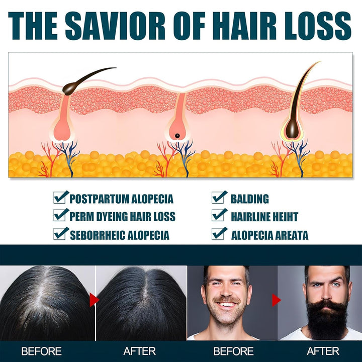 Miioto Hair Growth Serum, 180 ML Produs de creștere a părului pentru bărbați, ser de păr pentru creșterea părului, îngrijirea scalpului Promovează părul mai gros Hrănește scalpul și previne căderea părului Ingrijirea parului Naty Shop