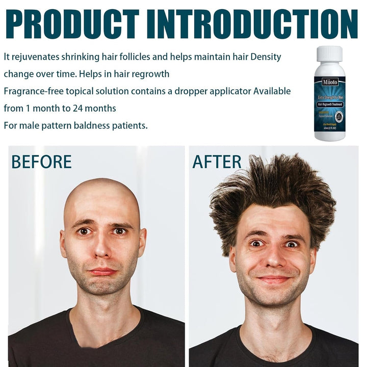 Miioto ser de creștere a părului, produs de creștere a părului pentru bărbați, ser de păr pentru creșterea părului, îngrijirea scalpului promovează părul mai gros hrănește scalpul și previne căderea părului, 3 * 60 ML Ingrijirea parului Naty Shop