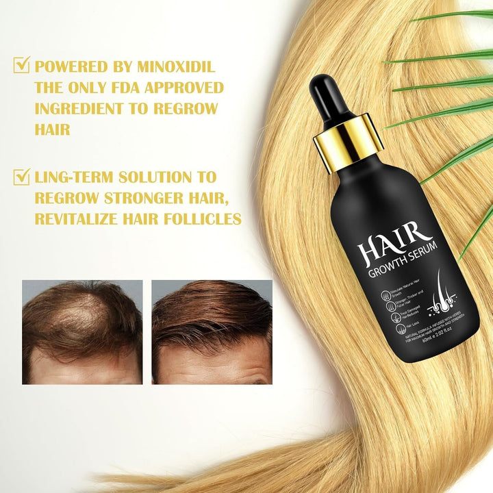 Ulei organic 5% pentru creșterea părului - Soluție pentru uz extern - Creșterea și îngroșarea părului - Pentru căderea părului și subțierea părului la bărbați - Reactivează foliculii reduși - Dozator cu pompă precisă, 60ml Ingrijirea parului Naty Shop